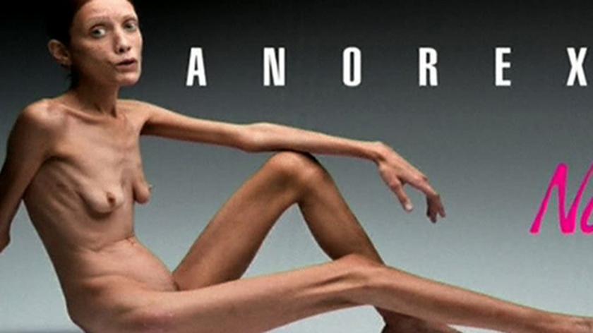 Moda w walce z anoreksją