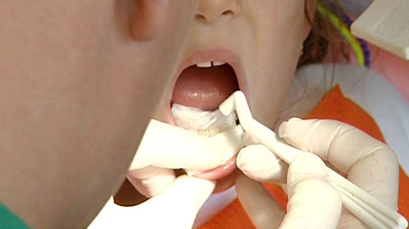 Polskie dzieci mają popsute zęby. To już "epidemia próchnicy"