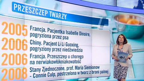 Najgłośniejsze przeszczepy twarzy na świecie