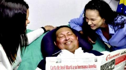 Pierwsze zdjęcia Chaveza po operacji