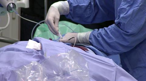 W poznaniu pod okiem specjalisty z londyńskiego szpitala lekarze operowali trzech natolatków