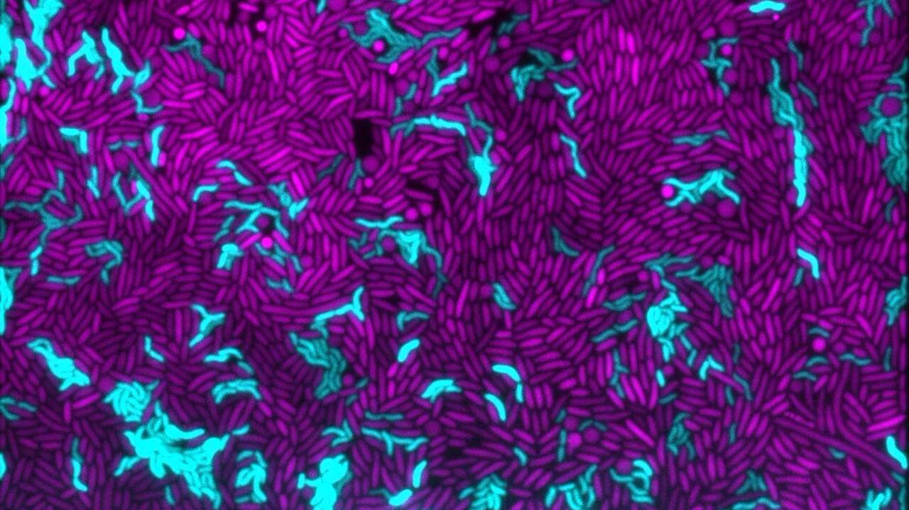 Co zjadają głodne bakterie. Zaskakujące odkrycie