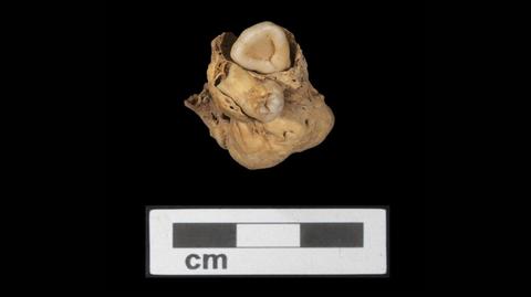 Potworniak jajnika znaleziony w Egipcie