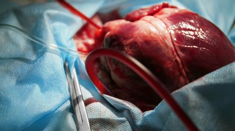 Kardiolog Marcin Grabowski o testach na zawał serca