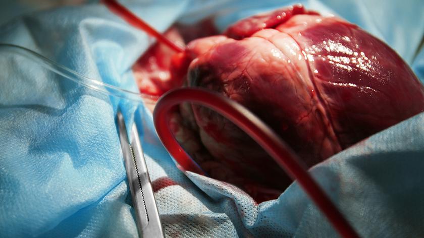 Kardiolog Marcin Grabowski o testach na zawał serca