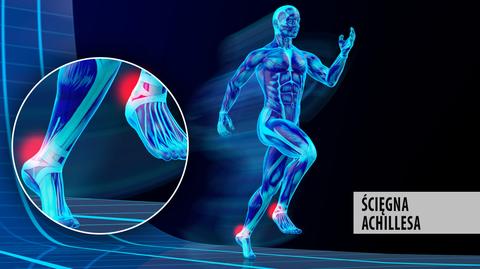 Ból ścięgna Achillesa - to jedna z najczęstszych przypadłości biegaczy