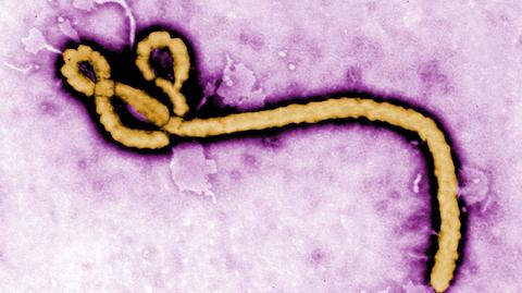 Preparaty na Ebolę są już w fazie eksperymentu