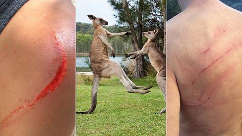 Ataki kangurów