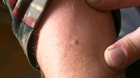 Plaga komarów po powodzi w 2010 roku (TVN24)