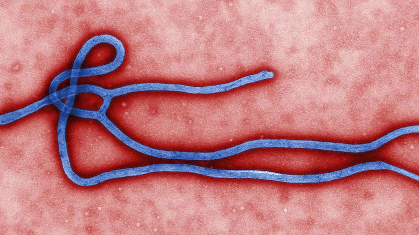 Procedury przyjęć pacjentów z podejrzeniem zakażenia ebolą (TVN24)
